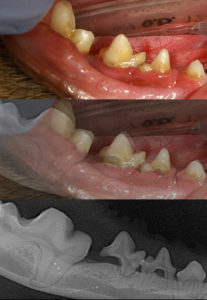 dental xrays