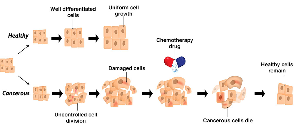 cancer and chemotherapy illustration